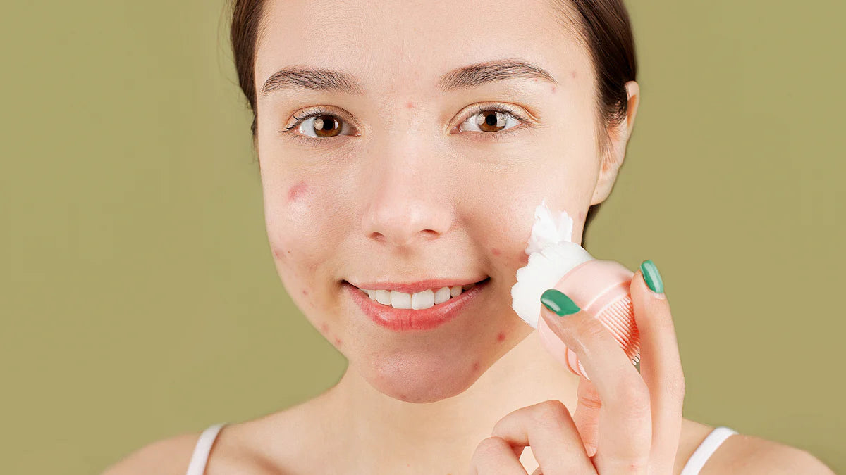 大人のニキビの原因と正しいケア方法