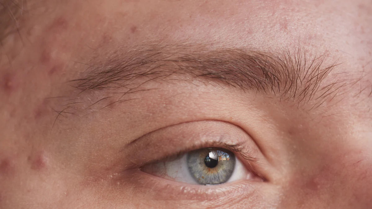 毛穴の開きの原因と効果的な対策を徹底解説